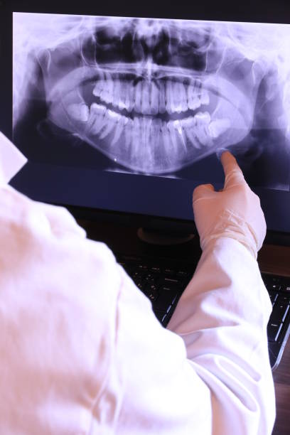 Best Emergency Tooth Extraction in Cutlerville, MI
