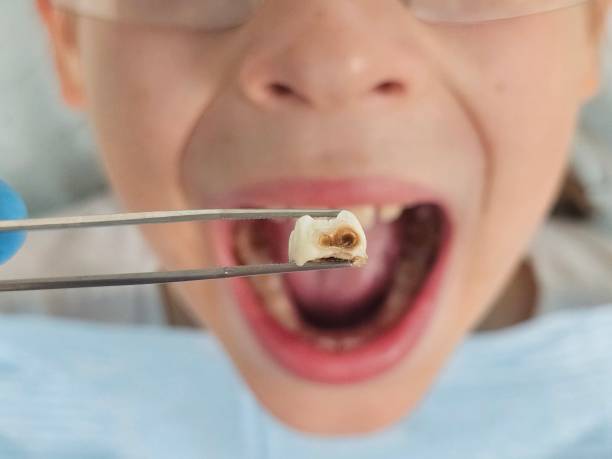 Best After-Hours Emergency Dentist in Cutlerville, MI