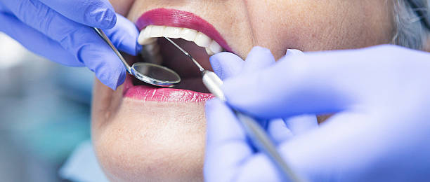 Best Emergency Treatment for Toothache in Cutlerville, MI
